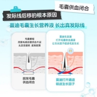 米諾地爾酊(蔓迪)