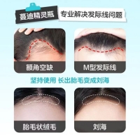 米諾地爾酊(蔓迪)