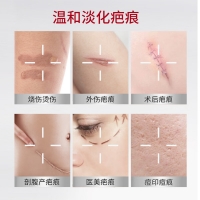 丹芎瘢痕涂膜(丹膚新)