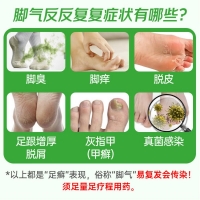 珊瑚癬凈(神奇)