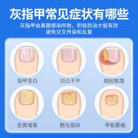 鹽酸阿莫羅芬搽劑(楚甲)
