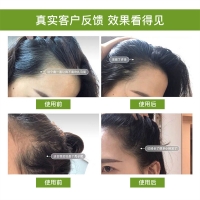 霸王育发防脱洗发液(防脱型)+毛囊滋养原液+霸王防脱调理发膜