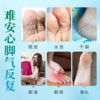 壳聚糖脚轻松喷雾剂(葵花)