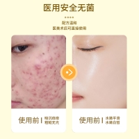 医用重组Ⅲ型人源化胶原蛋白敷贴(葵花)