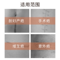 硅凝胶疤痕修复贴(舒奈美)