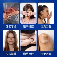 赛维牌水飞蓟磷脂片(九芝堂)