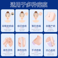 硅酮疤痕凝胶