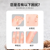 抑菌膏(安兴堂)