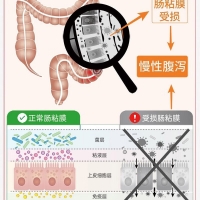 酪酸梭菌活菌胶囊(阿泰宁)