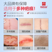 疤痕凝胶(白云山)