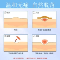 医用退热凝胶（疣清宁）