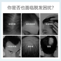 米诺地尔搽剂(发教授)