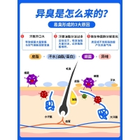 甲正王除臭液(甲正王)
